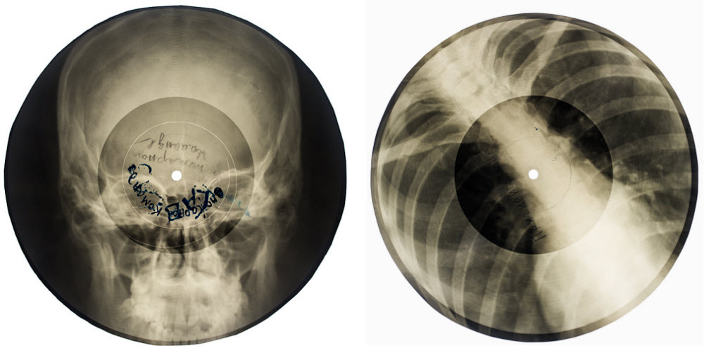 Bone music Electronic Beats